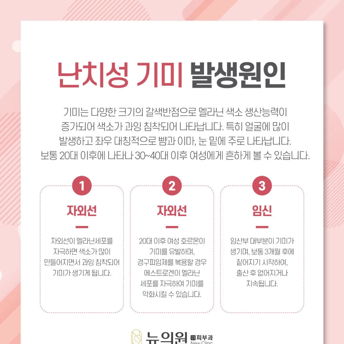 난치성 기미가 생기는 원인을 정리한 뉴의원 안내 카드 이미지